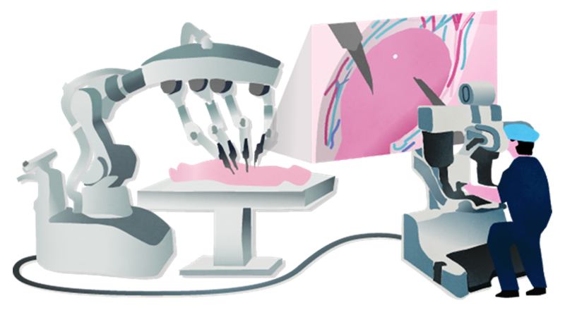 ロボット支援手術イメージ