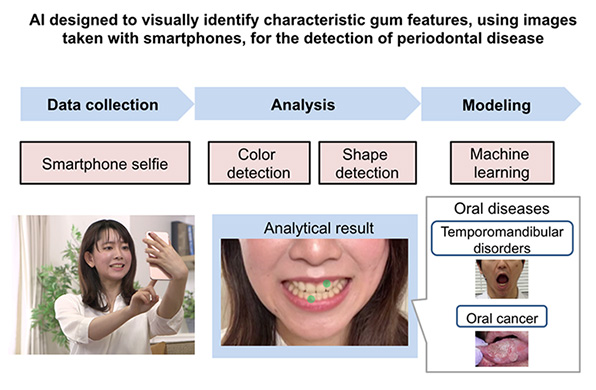 Overview of Periodontal Disease Detection AI