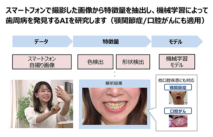 図：歯周病発見AIの概要